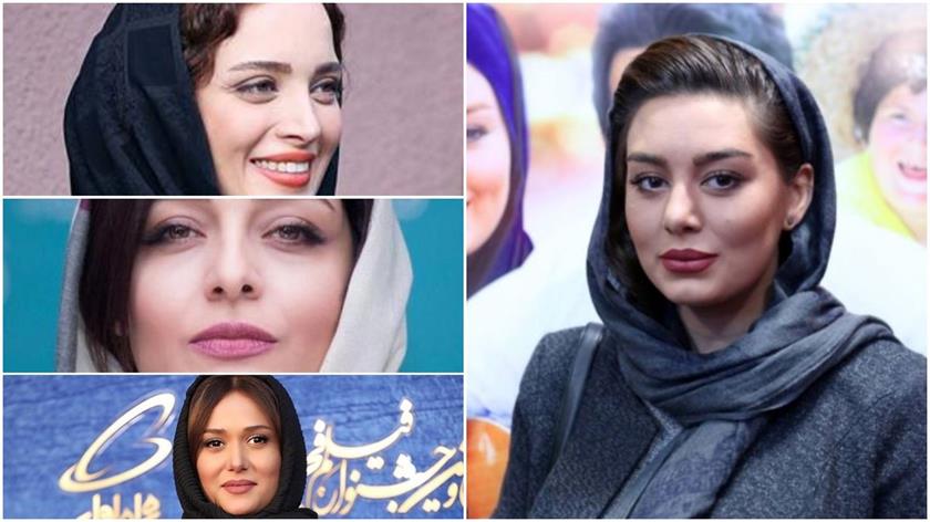 کدام بازیگران ایرانی عمل زیبایی از جمله پوست و عمل بینی انجام داده اند؟